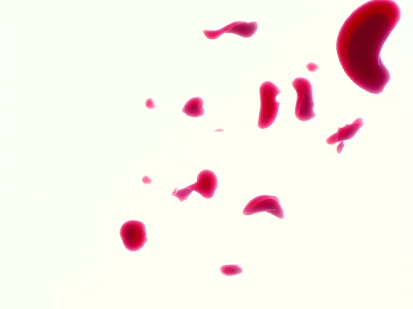 Sailor Moon Ep 102: The Stolen Pure Heart: Usagi's Crisis @ 00:08:17